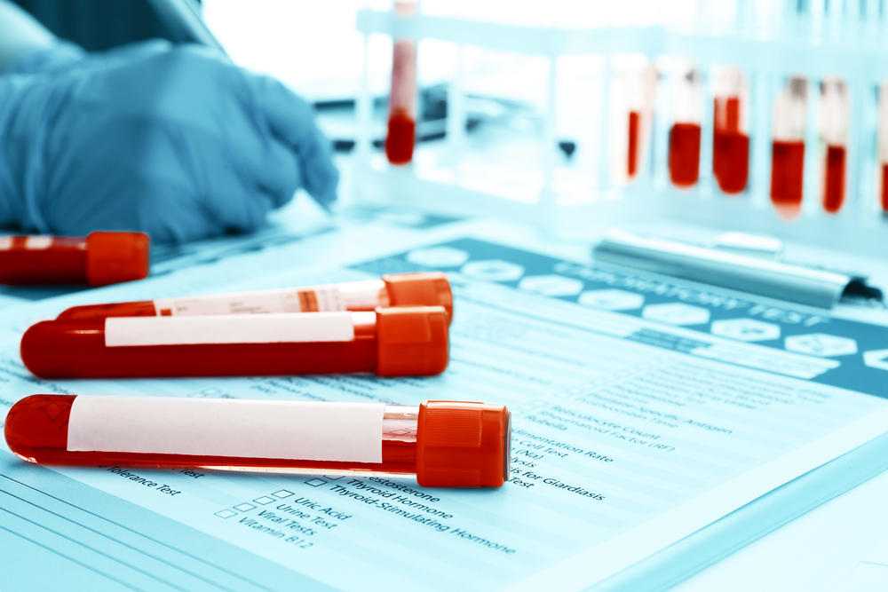 shutterstock_454668103 análise sangue
