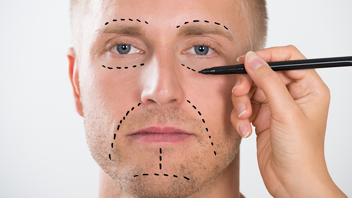 homem, cirurgia, face, rosto